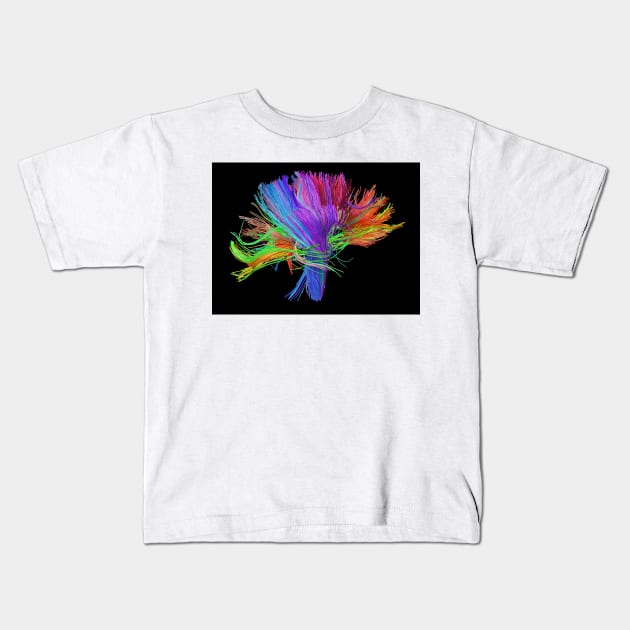 White matter fibres of the human brain (C023/9414) Kids T-Shirt by SciencePhoto